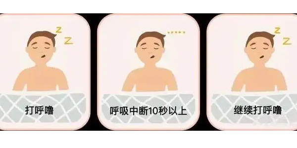 你真的了解睡眠呼吸暫停嗎？6600萬中重度患者正在受害！—仟龍醫(yī)療
