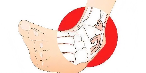 踝關(guān)節(jié)扭傷后的最佳應(yīng)對(duì)指南：簡(jiǎn)單四步，助力快速康復(fù)！